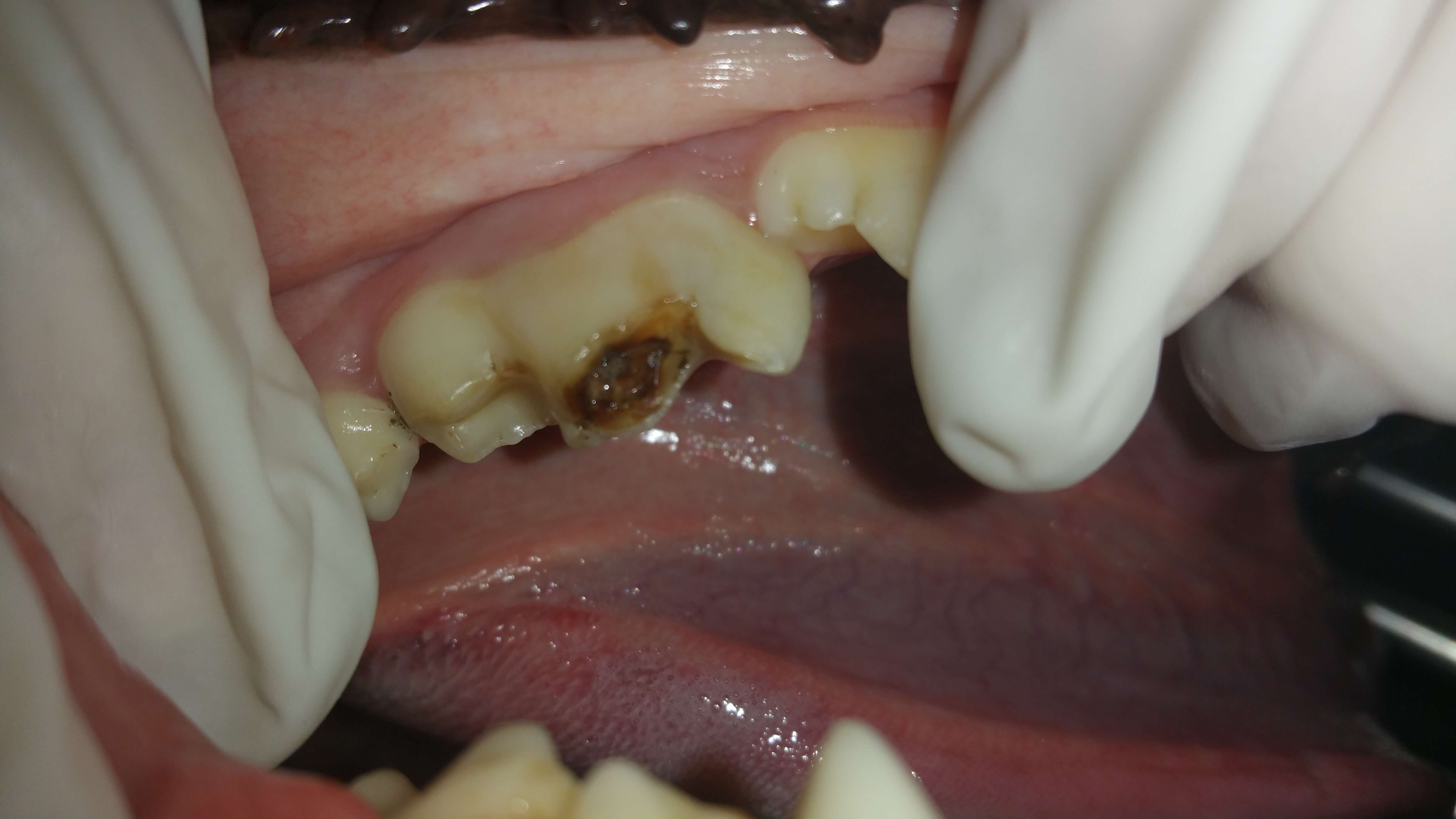 Filling a cavity in dogs tooth by  a dog dentist